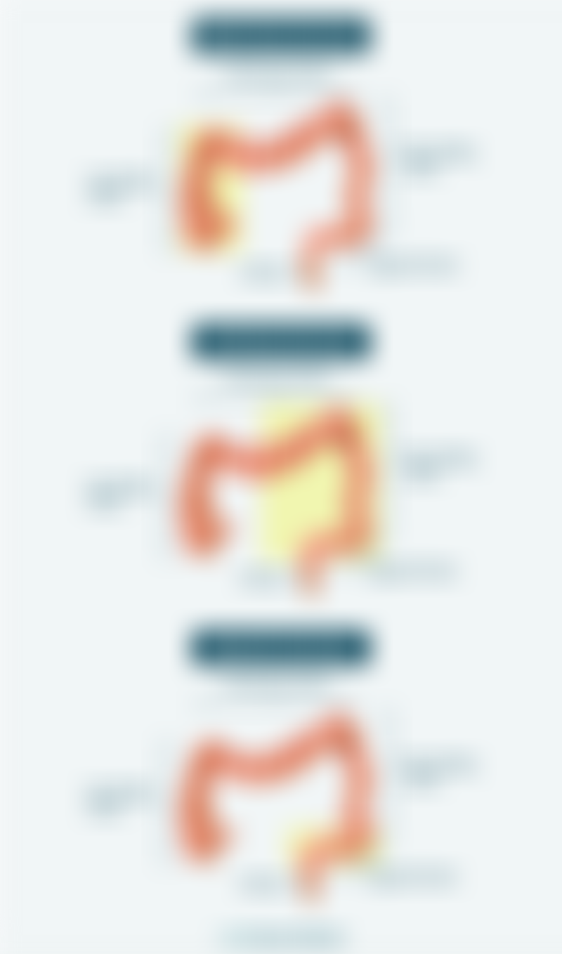 Types of Colectomy