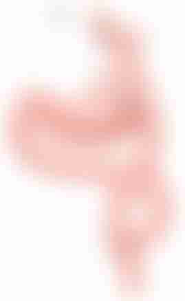 Postoperative Complications of Gastrectomy for Gastric Cancer