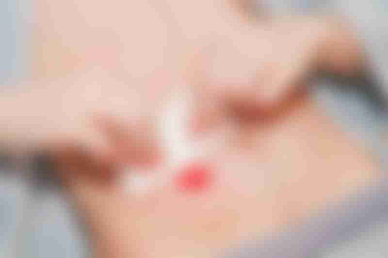 Young Man with Stoma