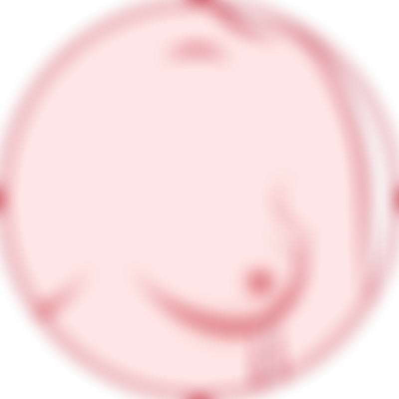 Breast Cancer Breast Lump