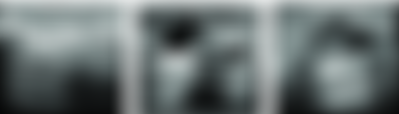 Samples of Ultrasound Breast Image
