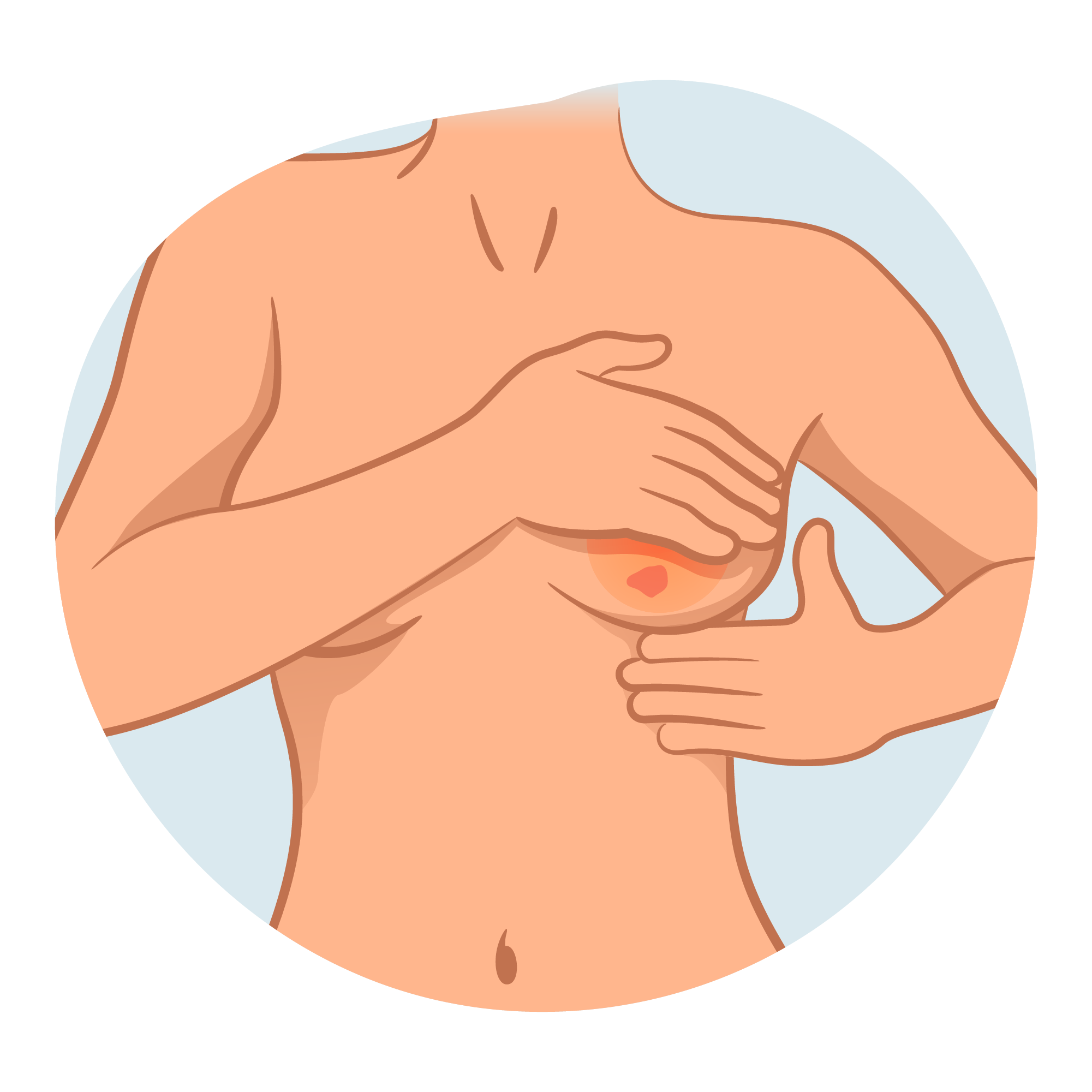 Symptoms Breast Cancer 7