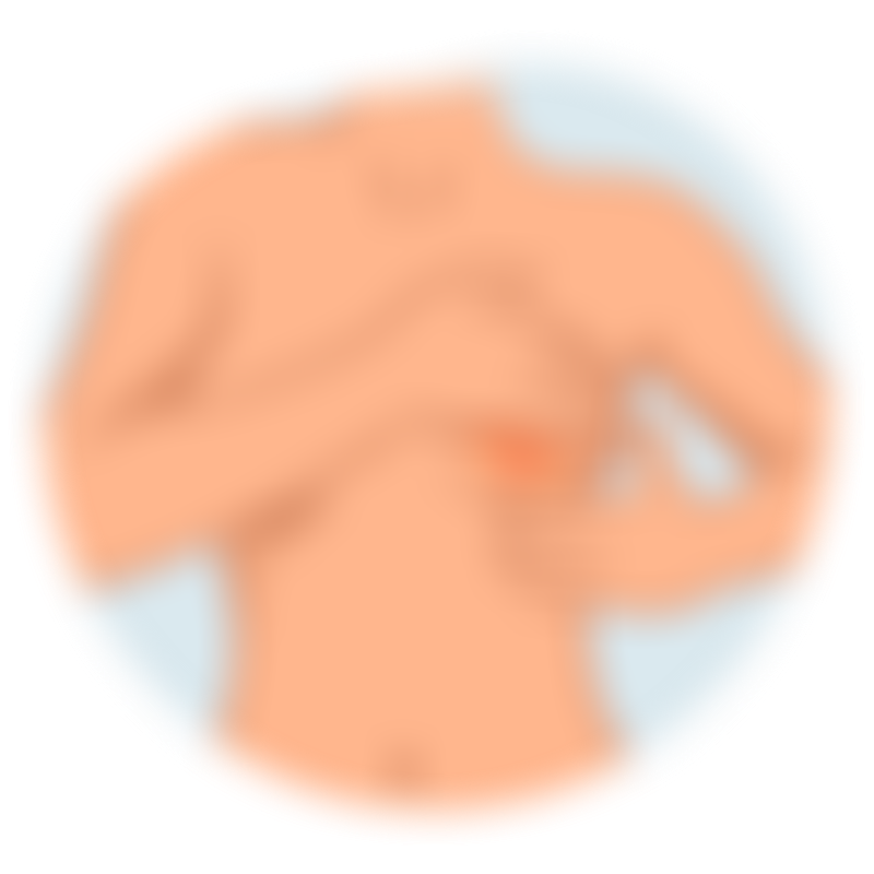 Symptoms Breast Cancer 7