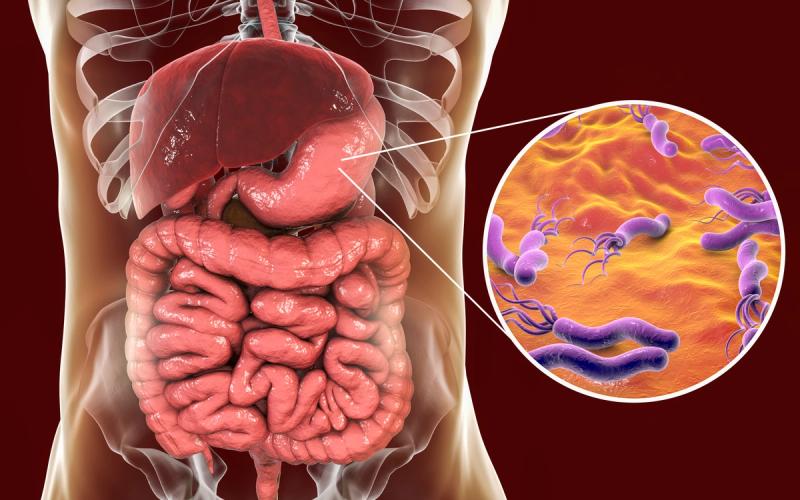 Risk Factors for Stomach Cancer
