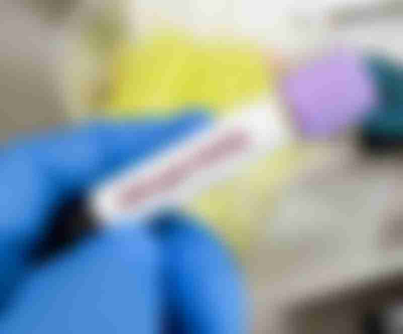 CDH1 Gene Testing