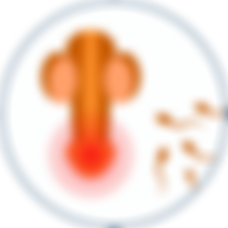 Prostate Cancer Painful Ejaculation