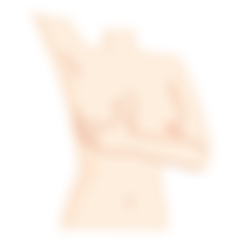 Symptoms Breast Cancer 2