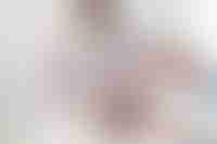 Prostate Cancer Model