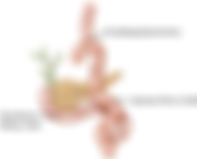 Postoperative Complications Gastrectomy Total Gastrectomy Roux En