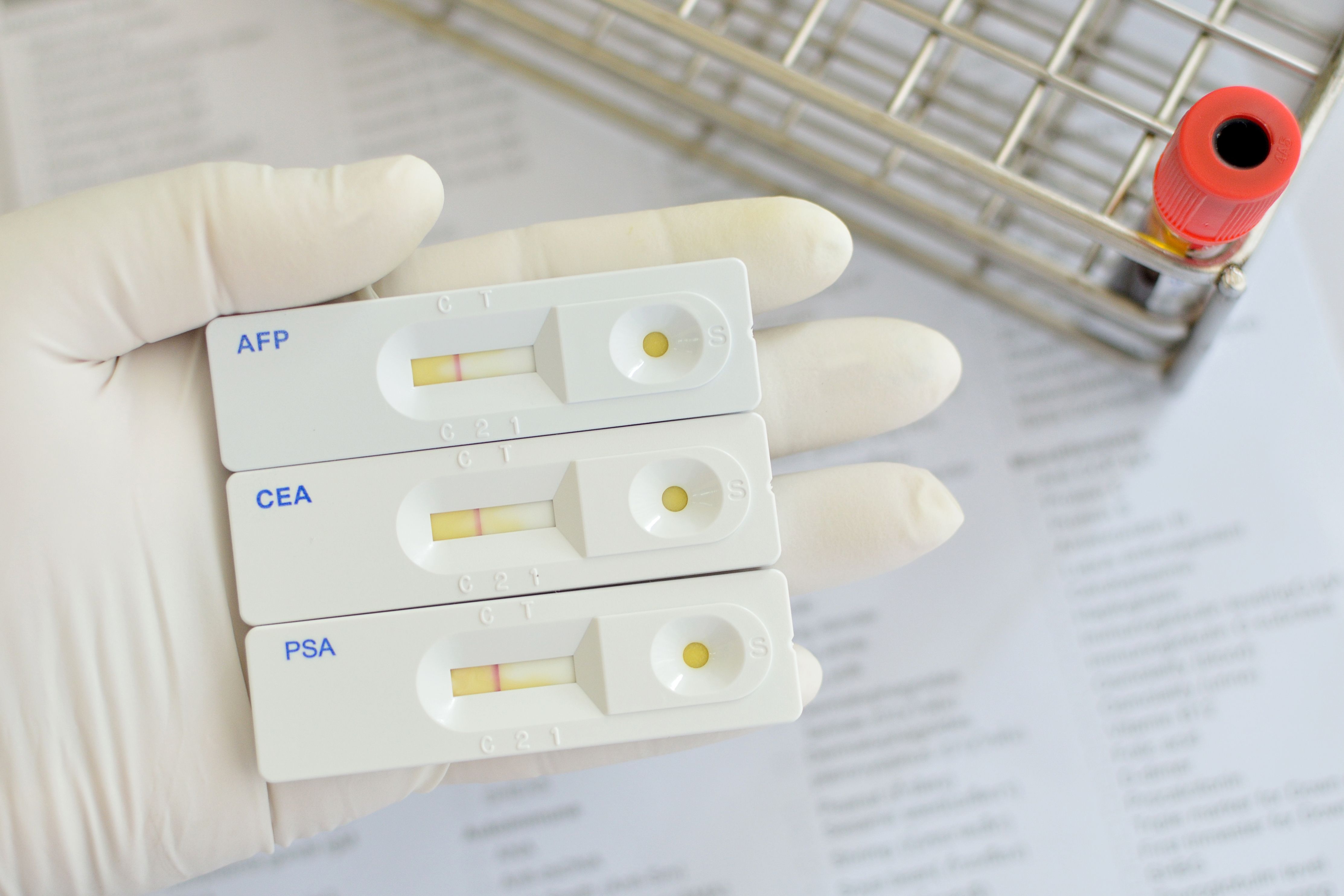 An Introduction to Colorectal Cancer Biomarkers