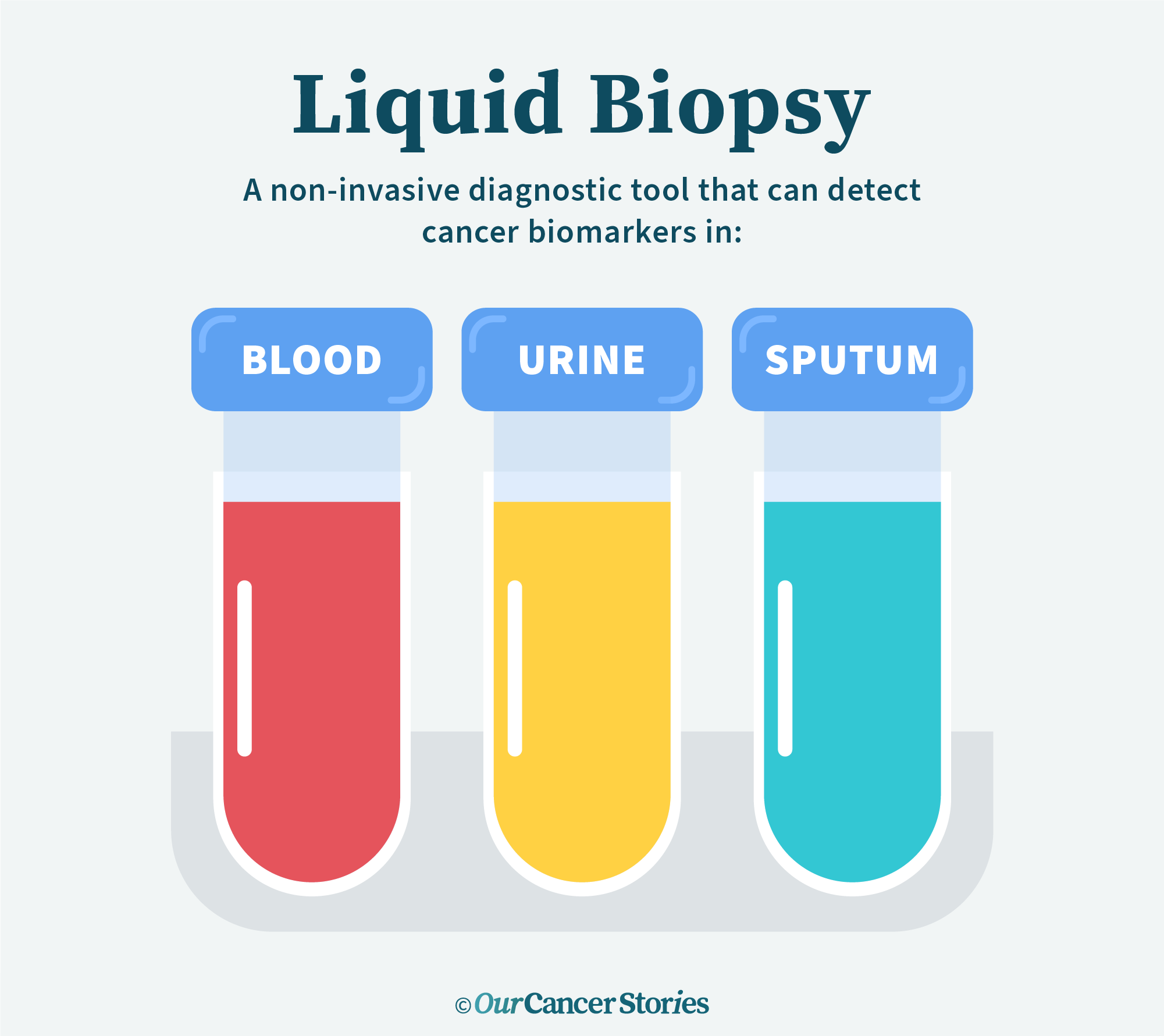 Lung Cancer Liquid Biopsy