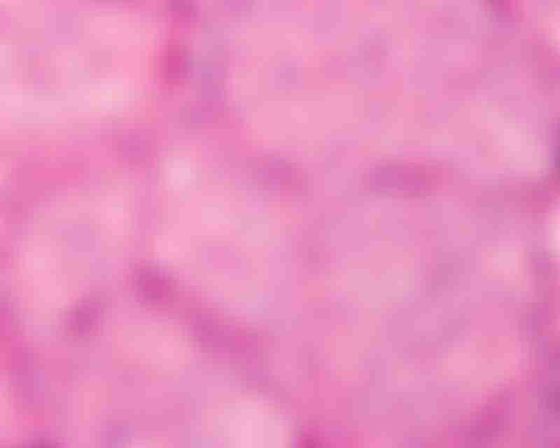 Gastric Neuroendocrine Tumor Cells