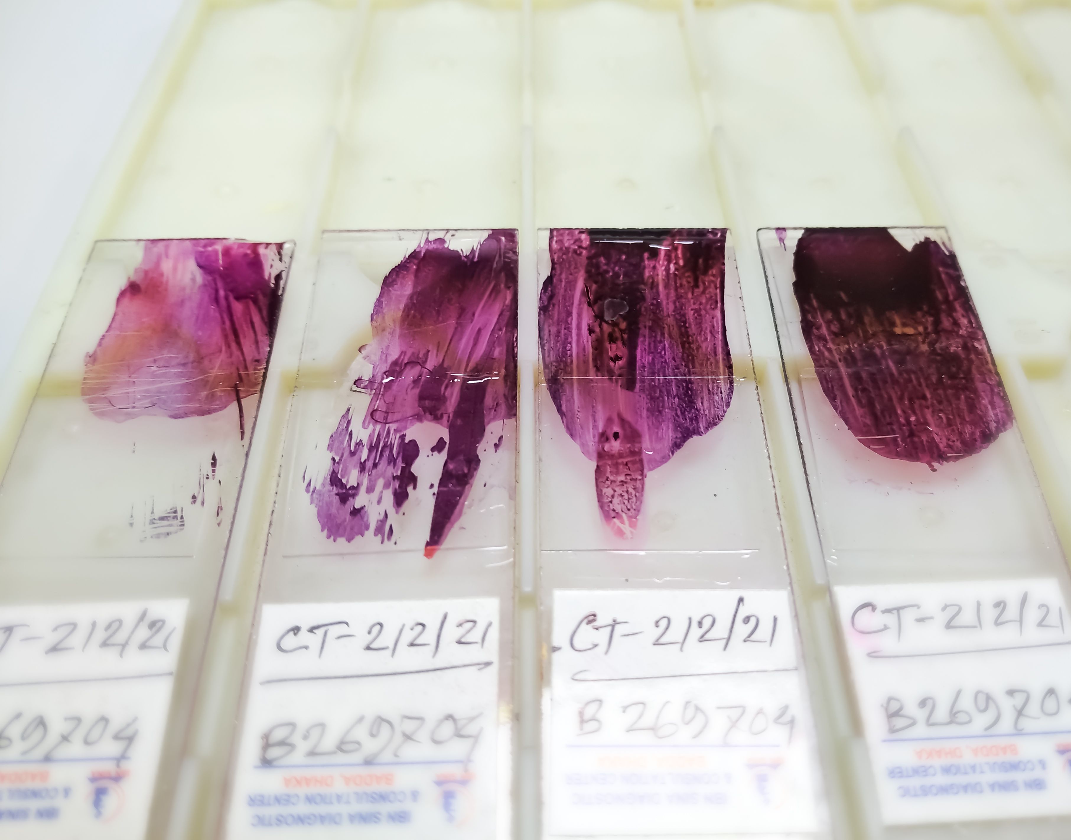 Understanding Your Pathology Report: An Overview