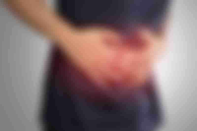 Stomach Ache
