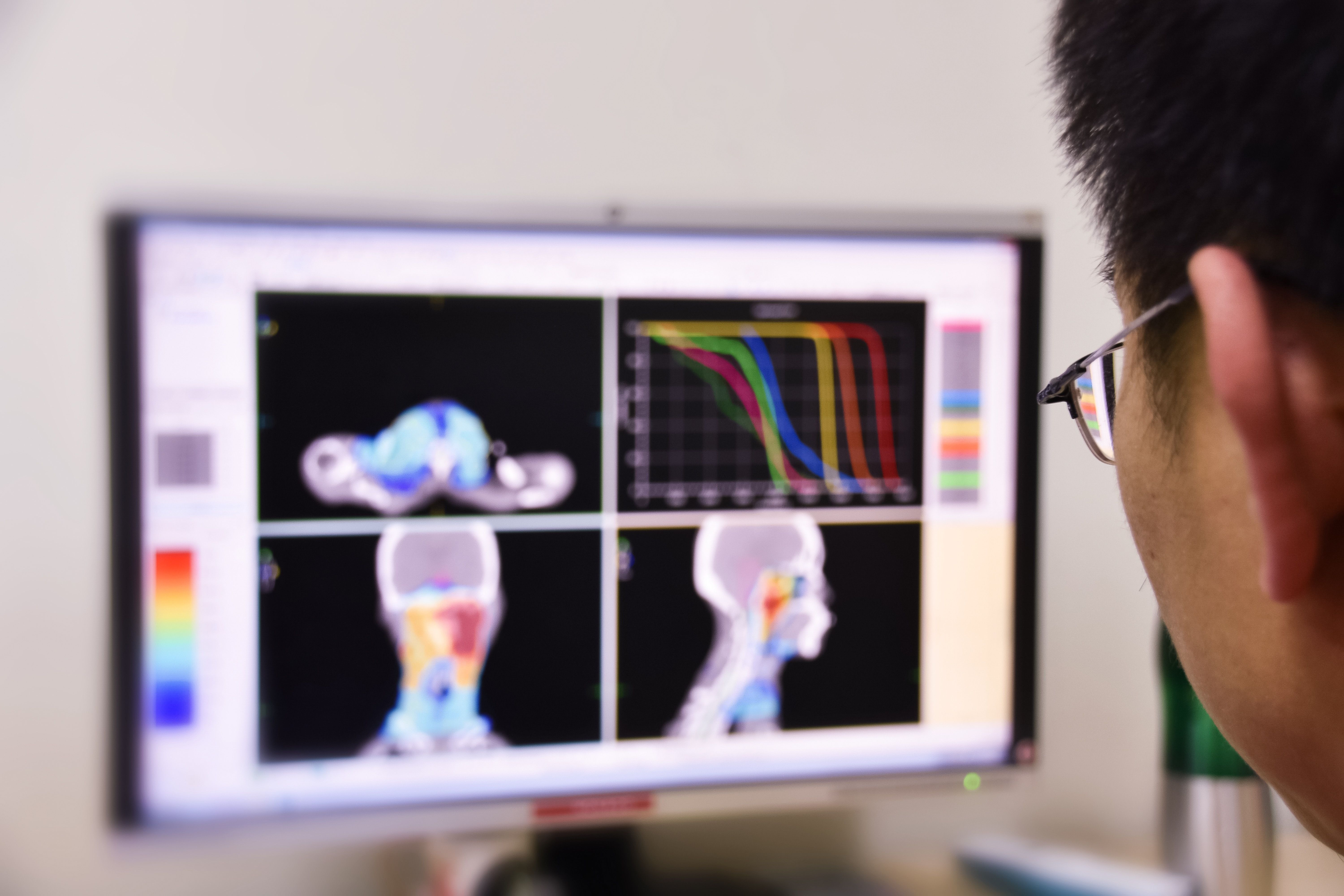 Radiation Therapy Planning