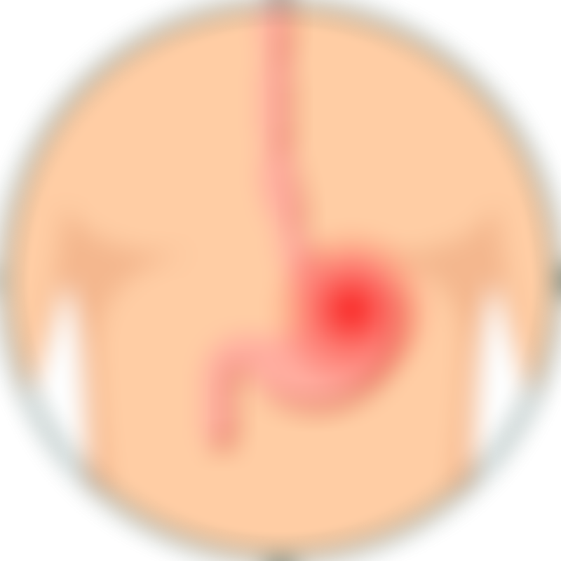 Gastric Cancer Heart Burn Indigestion