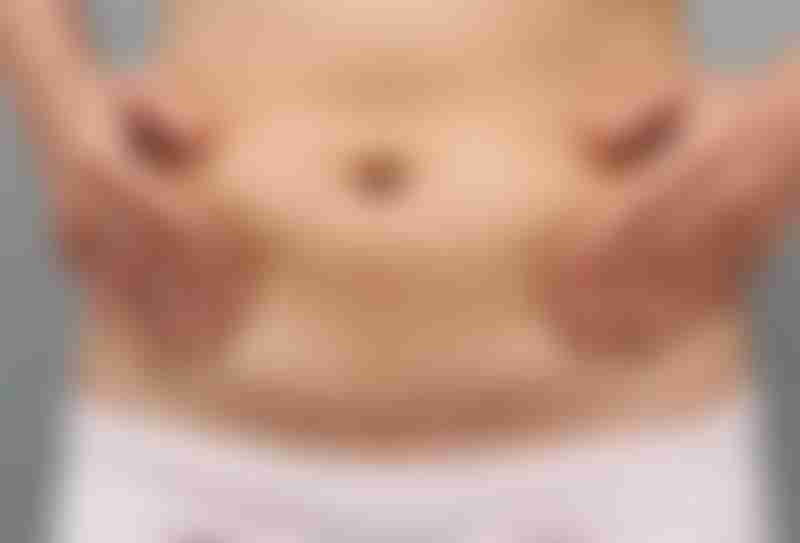 Close up of a abdomen scar