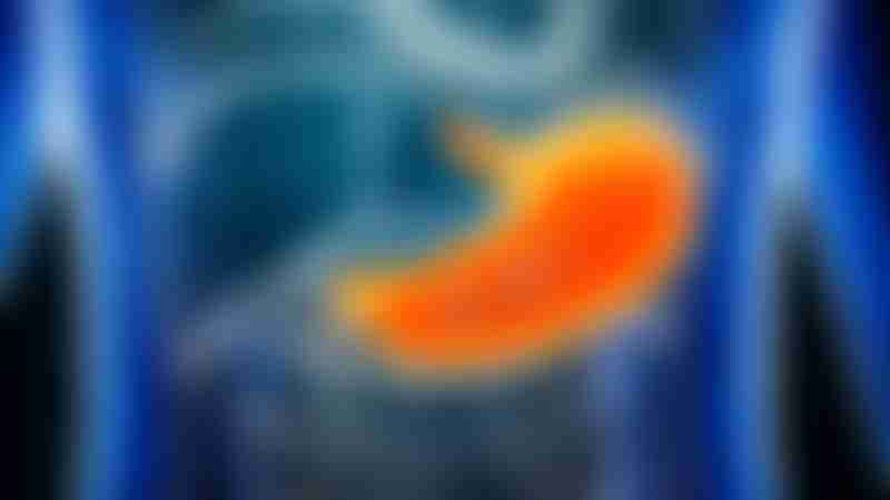 Cancer in Stomach