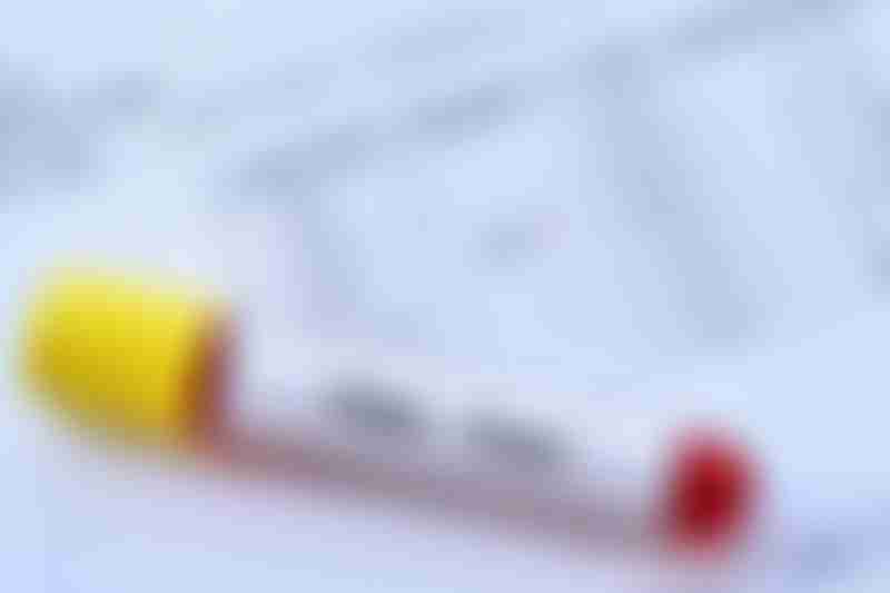 Treatments for Castration Resistant Prostate Cancer