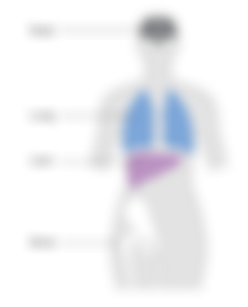 Where Metastatic Breast Cancer Most Commonly Spreads to