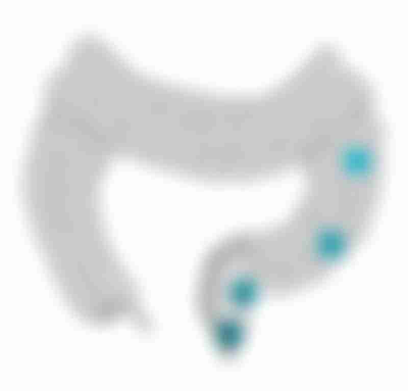 Polyp Location