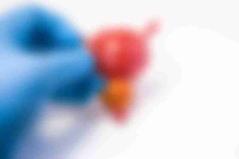 Prostate Biopsy