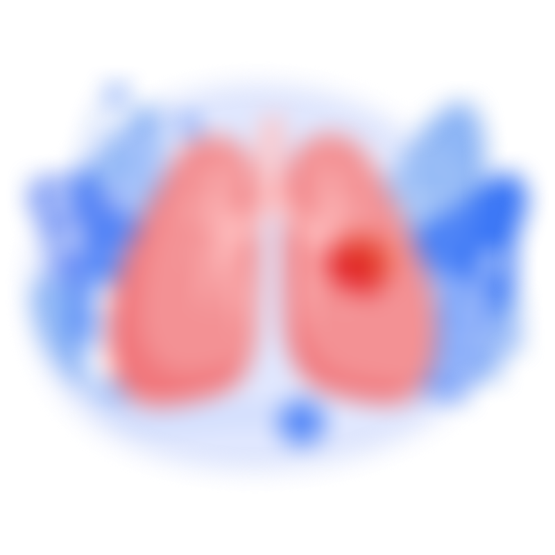 Symptoms Lung Cancer 1