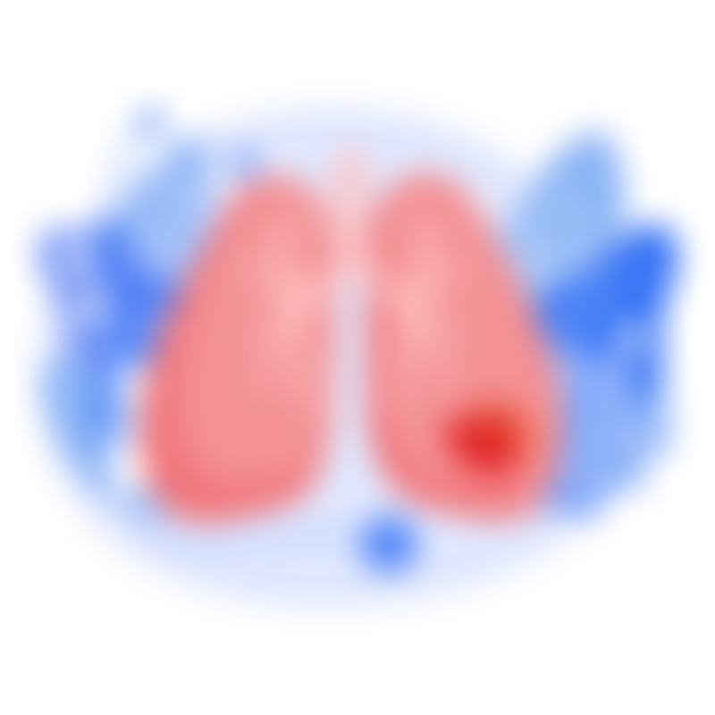Symptoms Lung Cancer