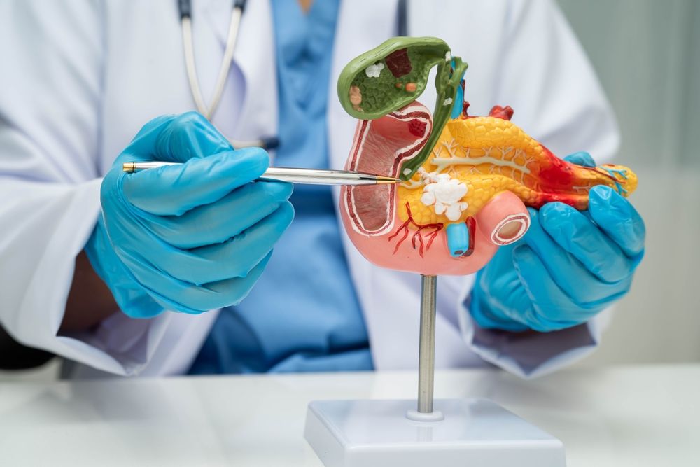cancer image