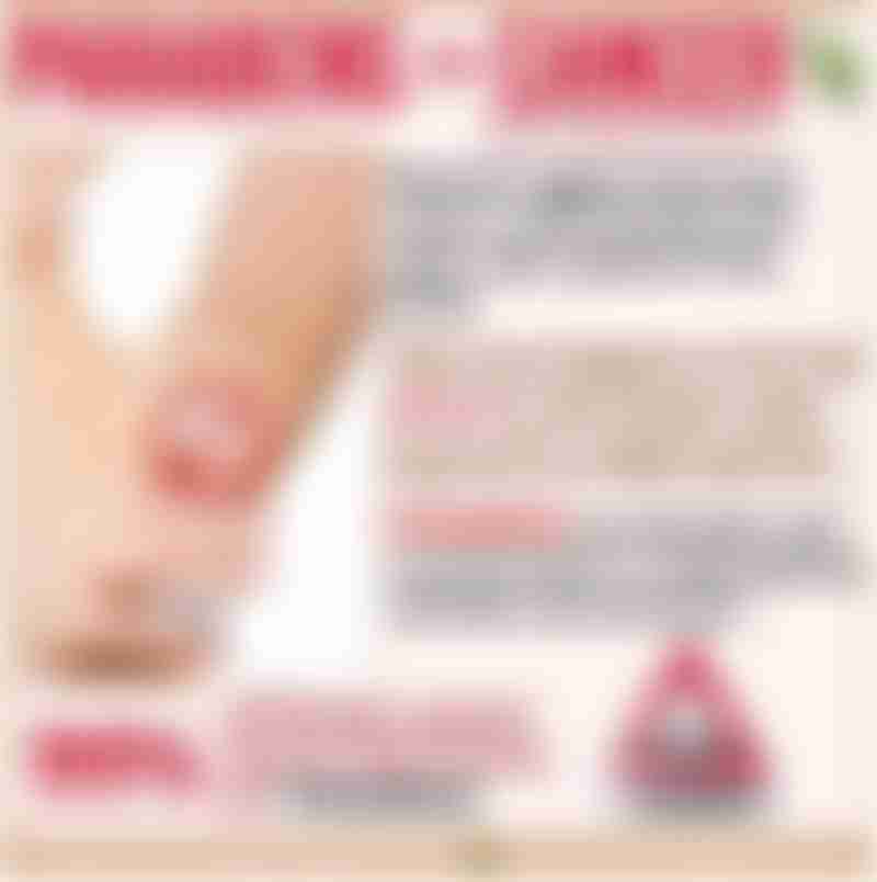 Breast Cancer Risk Misconceptions