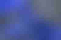 Woman Receiving Radiotherapy