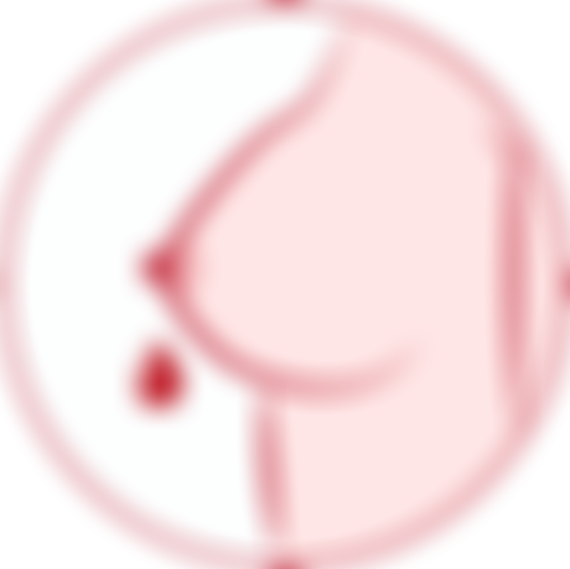 Breast Cancer Nipple Discharge