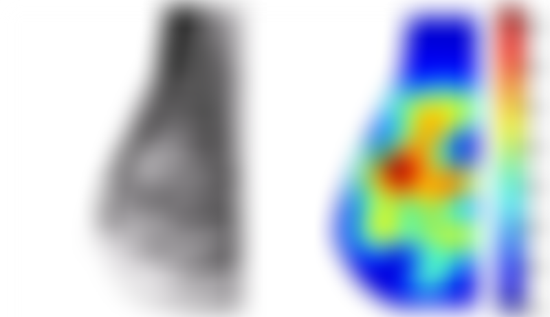 Tomographic Optical Breast Imaging