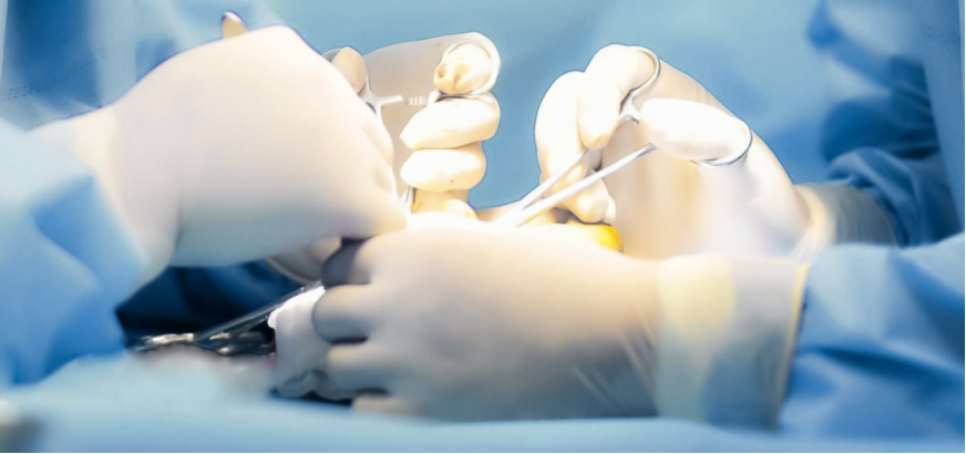 How Many Types of Surgical Gloves Are There?