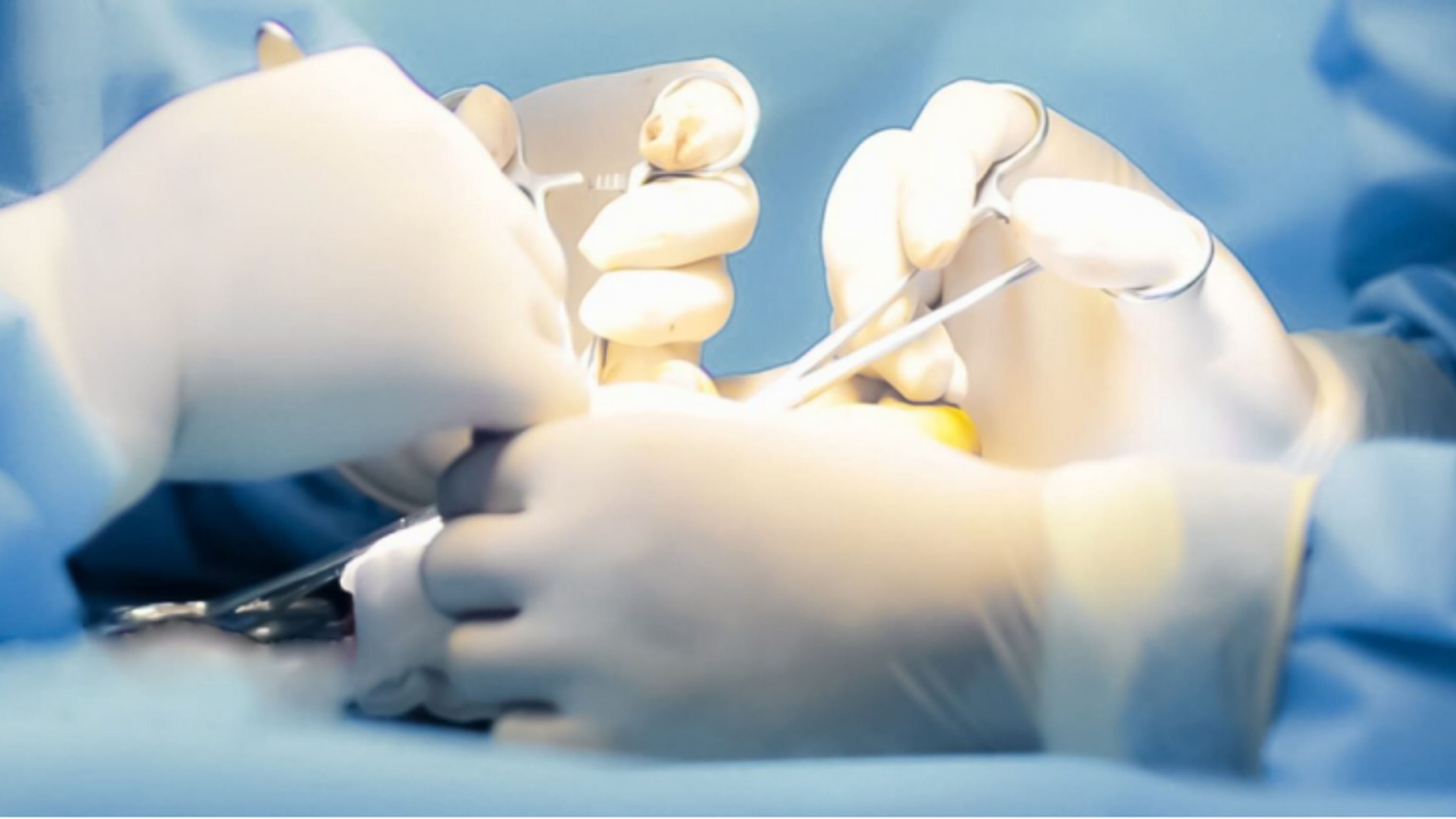 How Many Types of Surgical Gloves Are There?