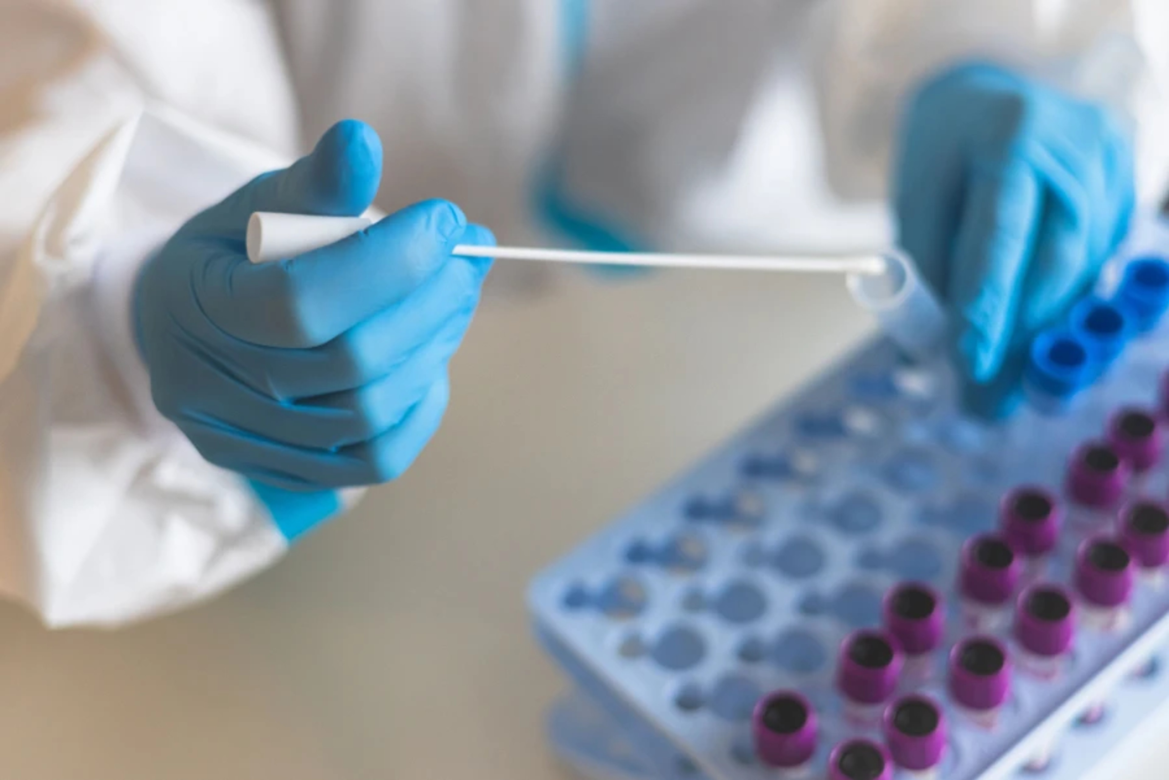 Disposable medical gloves used for precise sample handling in laboratory settings.