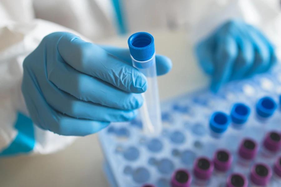 Nitrile Gloves for laboratory sample handling and analysis