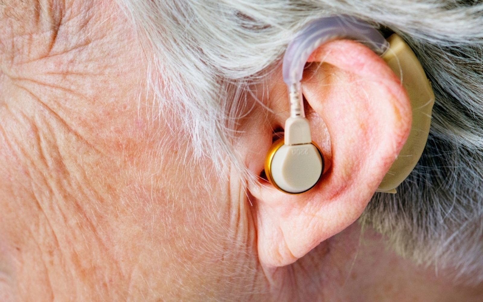Why Hearing Loss Beats Biohacks for Cognitive Longevity
