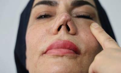 iyileşmek isterken hayatı kabusa döndü!