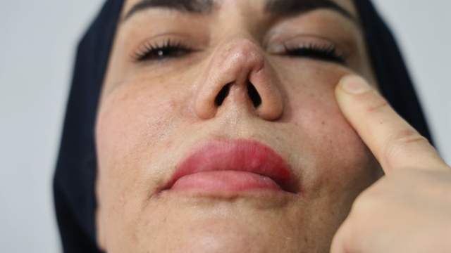 iyileşmek isterken hayatı kabusa döndü!
