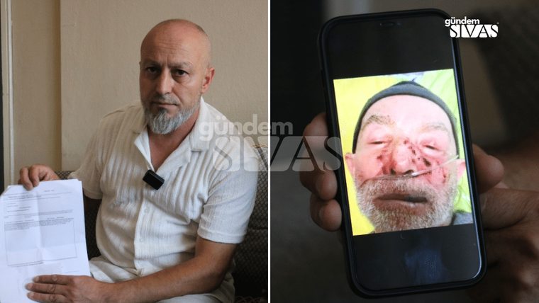 Kel bir adam belge tutarken, yanındaki telefonda yüzü şişmiş ve morarmış bir adamın görüntüsü yer alıyor.