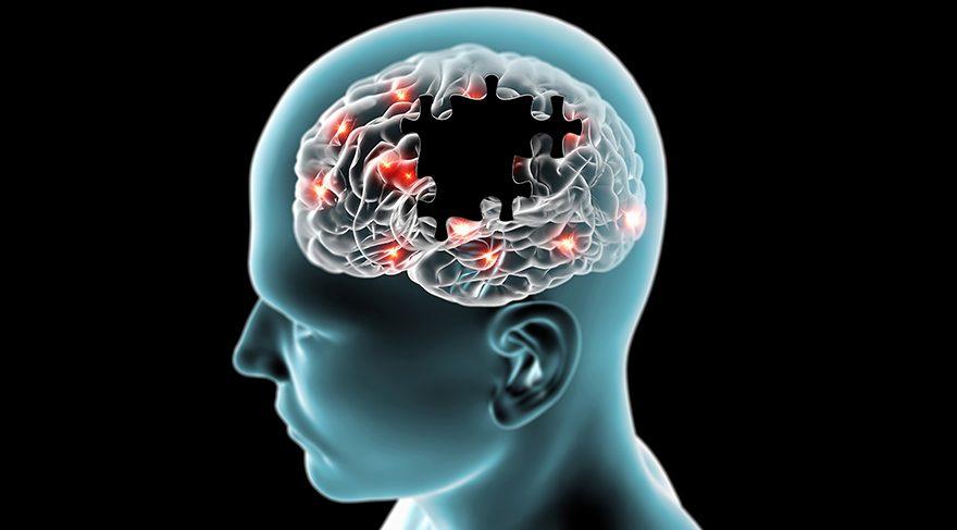 Bitkisel içerikli teknoloji ile Alzheimer tedavisi - Birlik Haber Ajansı