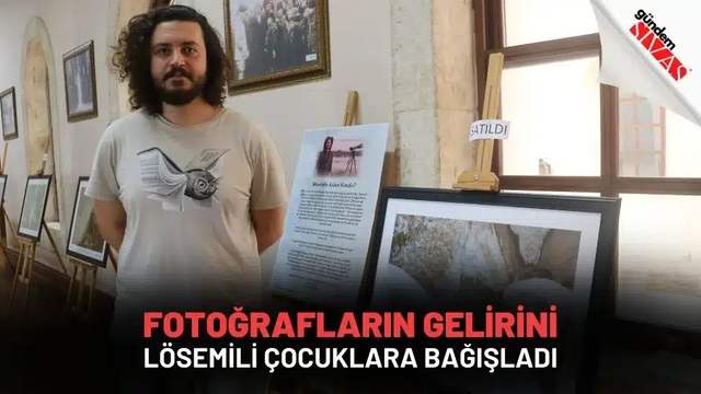 Fotoğrafların Gelirini Lösemili Çocuklara Bağışladı