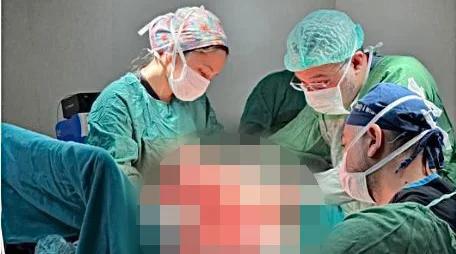 Sivas’ta 77 Yaşındaki Hastadan 8 Kiloluk Dev Tümör Çıkarıldı