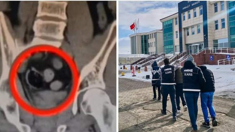 Tomografi görüntüsünde kırmızı daireyle işaretlenmiş nesneler ve “NARKO KARS” yazılı montlu üç kişi görülüyor.