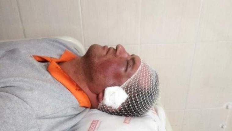 Kdz. Ereğli Belediyesinde belediye işçisine saldırı - Birlik Haber Ajansı