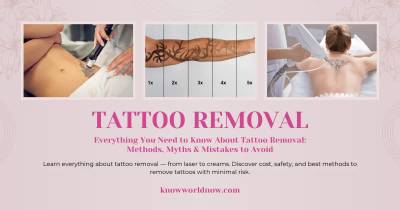 Everything You Need to Know About Tattoo Removal: Methods, Myths & Mistakes to Avoid