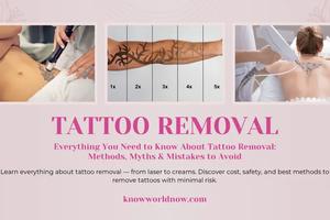 Everything You Need to Know About Tattoo Removal: Methods, Myths & Mistakes to Avoid