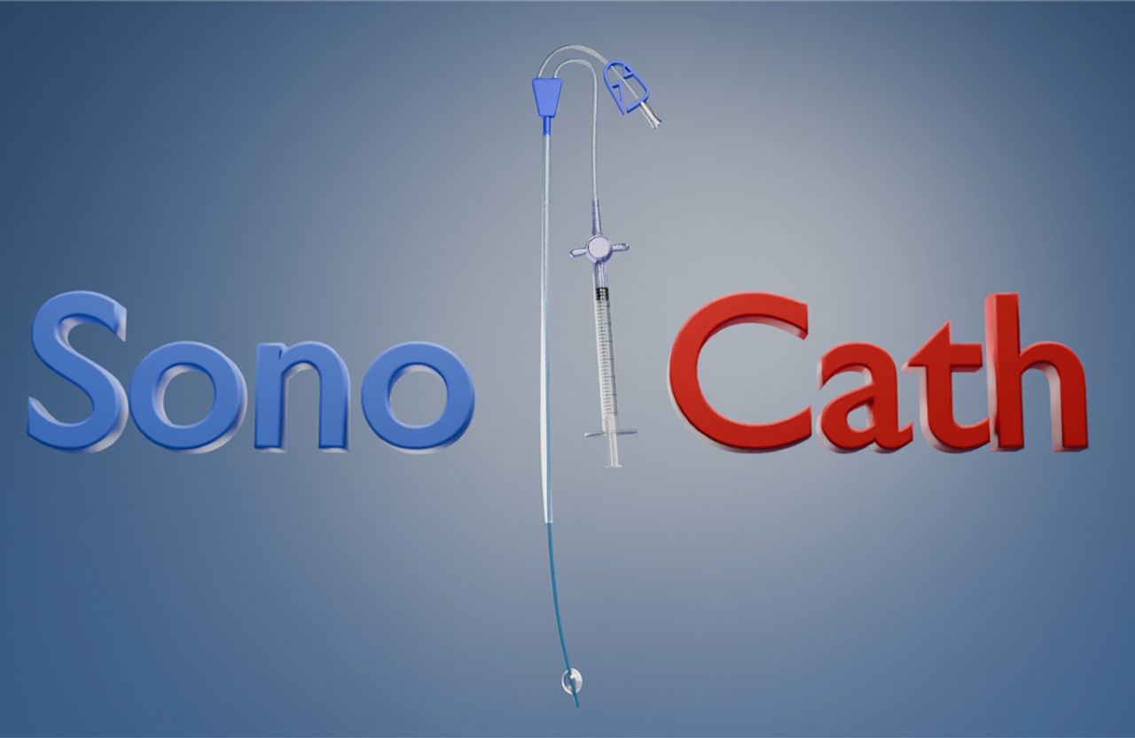 SonoCath — 3D Medical Device Animation