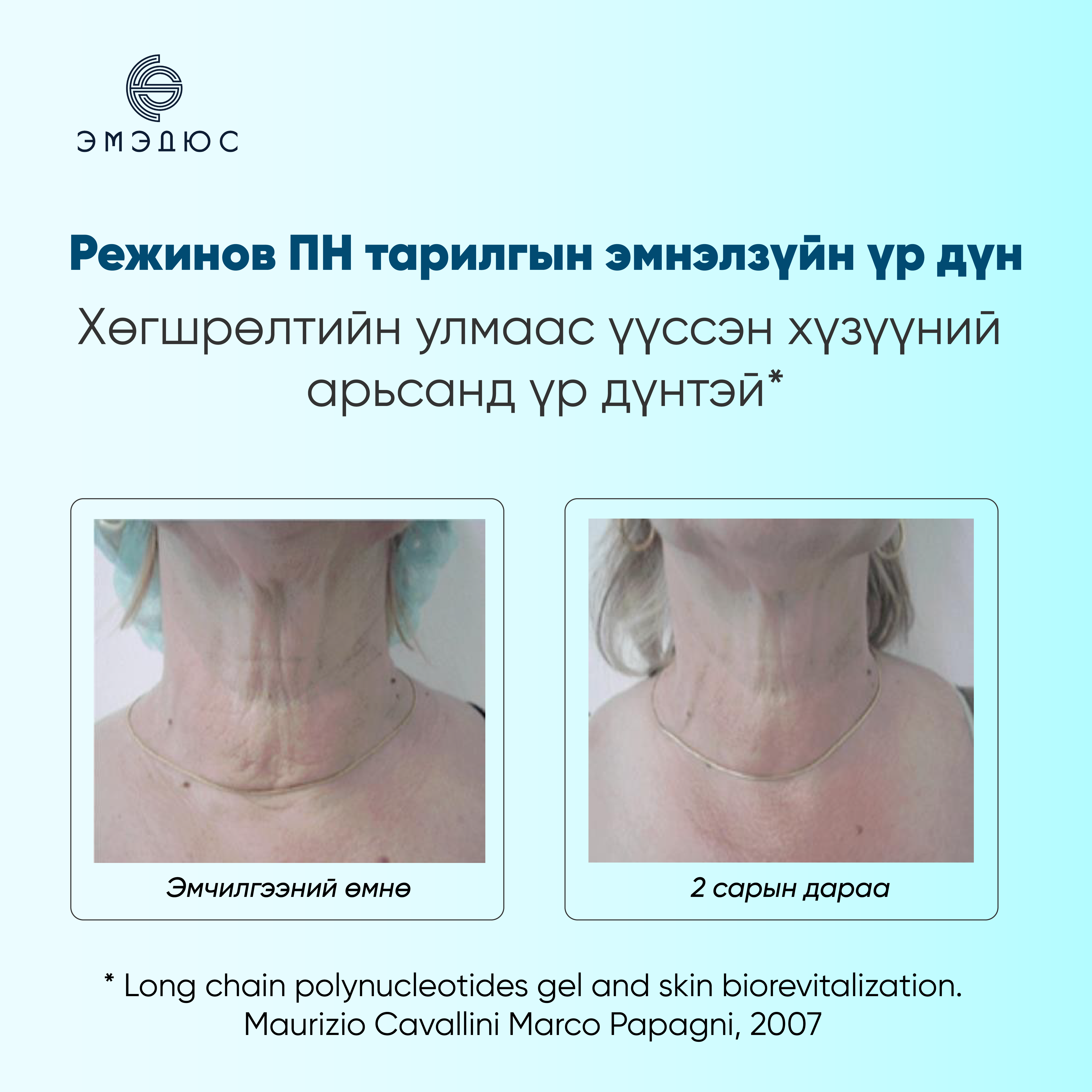 Режинов ПН 3мл